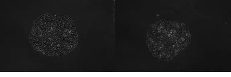 克隆1.png